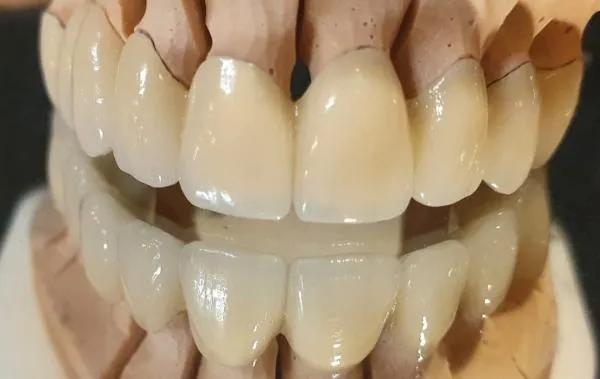 zęby 10