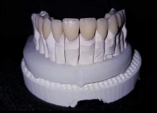 zęby 5